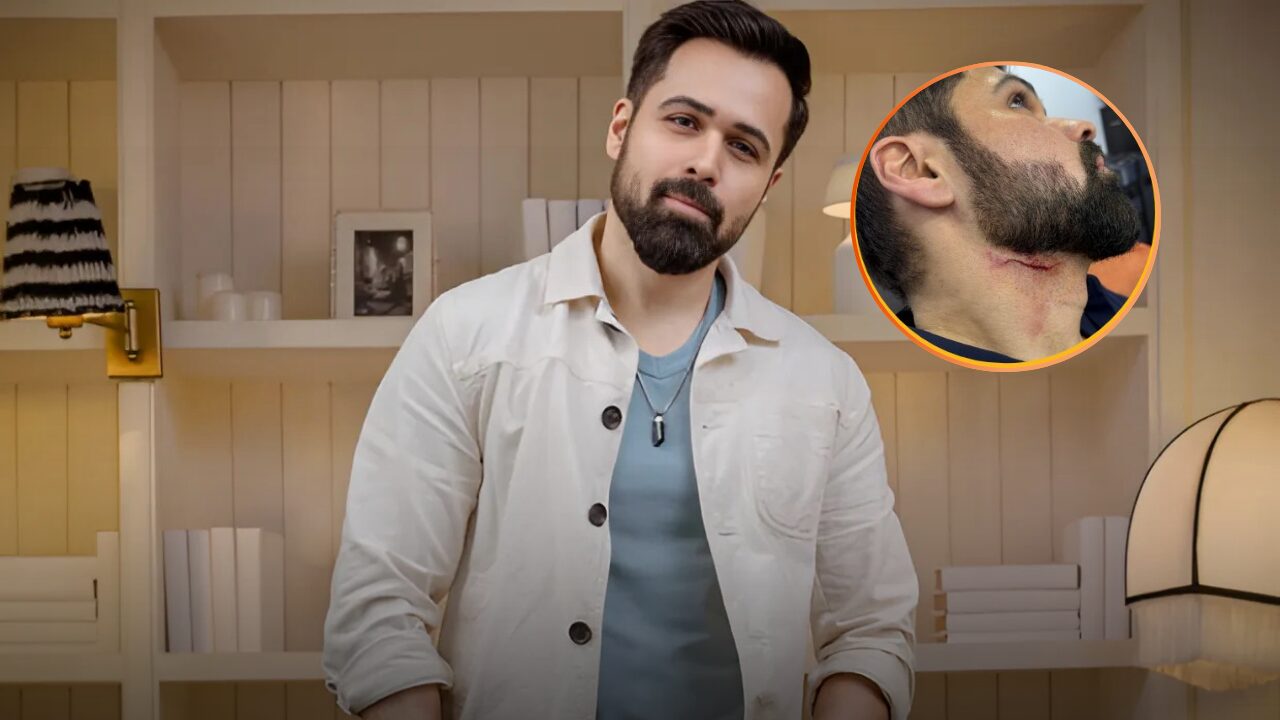 Emraan Hashmi Injured During Action Scene on Goodachari 2 Set in Hyderabad